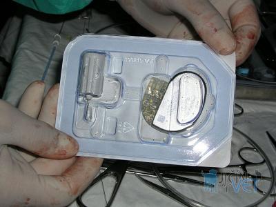 Kardiostimulátor s elektrodami