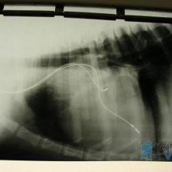 Rentgenový snímek elektrod kardiostimulátoru uchycených v srdci
