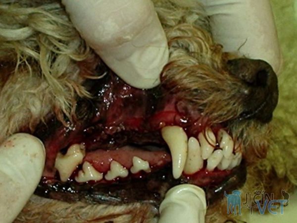 Tentýž pacient po odstranění zubního kamene ultrazvukem, u některých zubů bylo nutné provést extrakci pro pokročilou parodontózu. Velmi dobře jsou patrné zarudlé okraje dásní v důsledku zánětu a obnažené krčky stoliček.