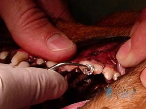 Ošetření zubního kazu u psů. Po pečlivém vysušení je pomocí tzv. cpátka celá dutina ošetřeného zubu vyplněna plombou, v tomto případě amalgámem.