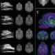 JNeurosci 2019, 0303-19